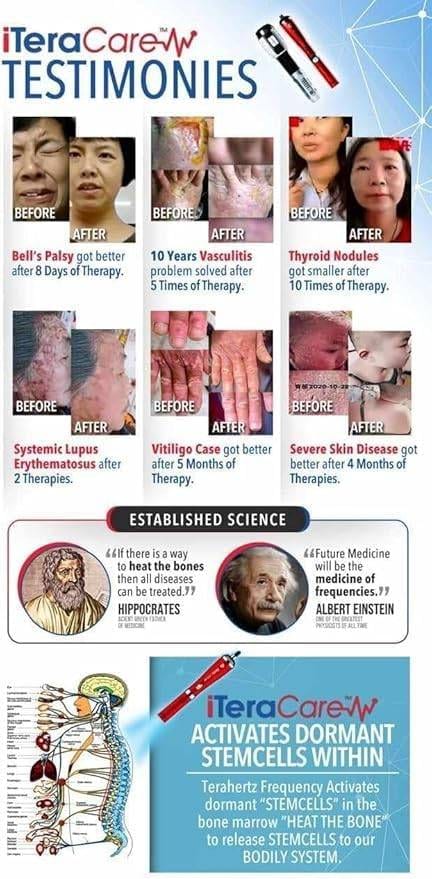 ITERACARE Classic Device for Pain Relief, Relaxation, and Circulation Beauty & Health Body Shaping Massage Equipment Massage & Relaxation Relaxation Treatment Ultrasonic Scaler